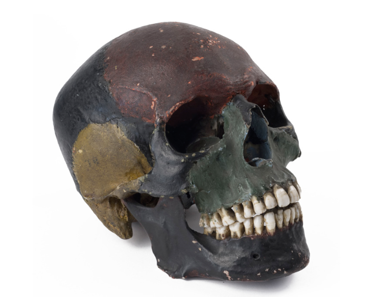 reperto osteologico: cranio